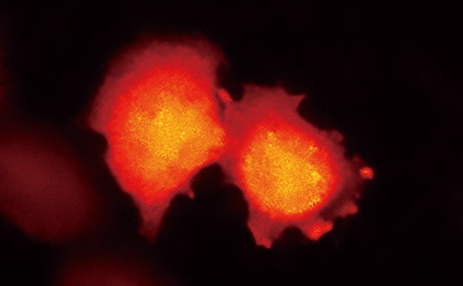 表达基于BRET的钙指示蛋白的HeLa细胞